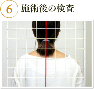 施術後の検査