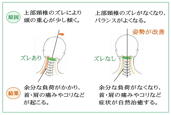 上部頸椎が整うとバランスが改善する