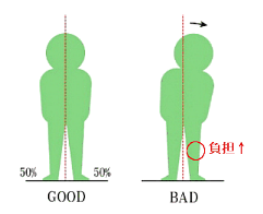 膝痛の説明図