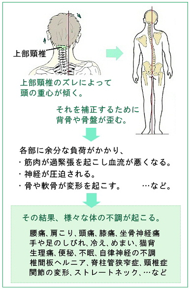 上部頸椎が原因である説明