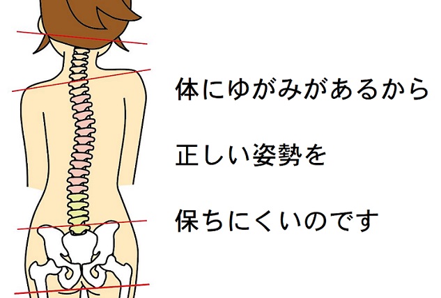 体のゆがみが悪い姿勢の原因をあらわすイラスト